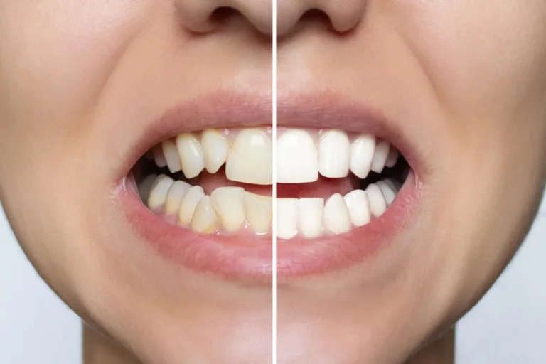Before & After Cosmetic Dentistry