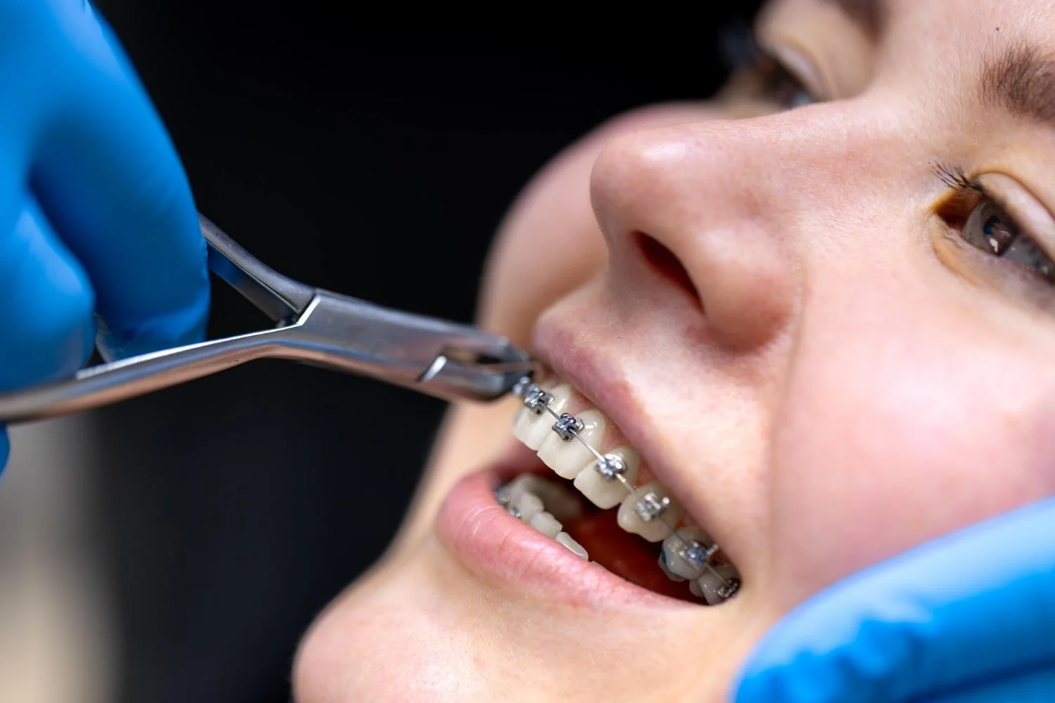 Orthodontist in Ahmedabad