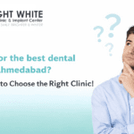 Detal Clinic In Ahmedabad