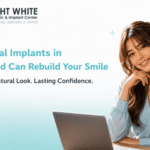 How Dental Implants in Ahmedabad Can Rebuild Your Smile