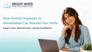 How Dental Implants in Ahmedabad Can Rebuild Your Smile