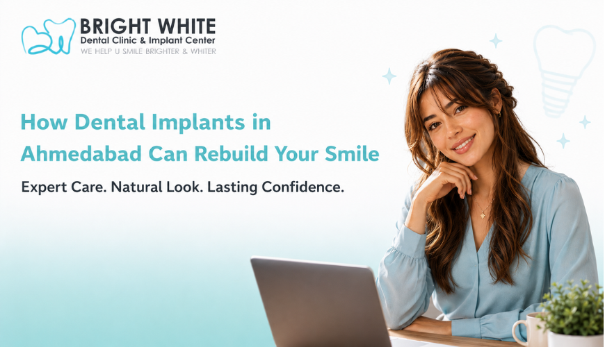 How Dental Implants in Ahmedabad Can Rebuild Your Smile