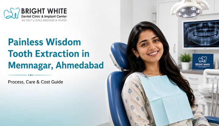 Wisdom Tooth Extraction-memnagar